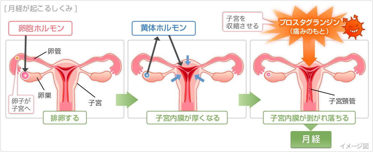 月経痛が起こるメカニズム